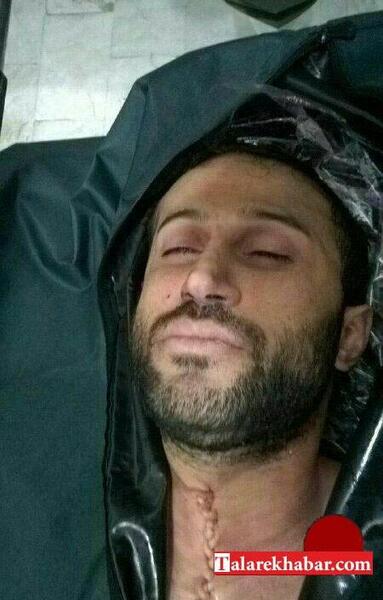 عکس وحشتناک کالبدشکافی