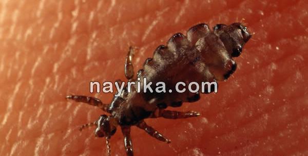 عکس از شپش سر انسان