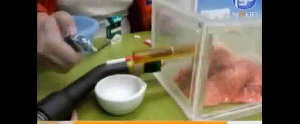 عکس ریه واقعی انسان