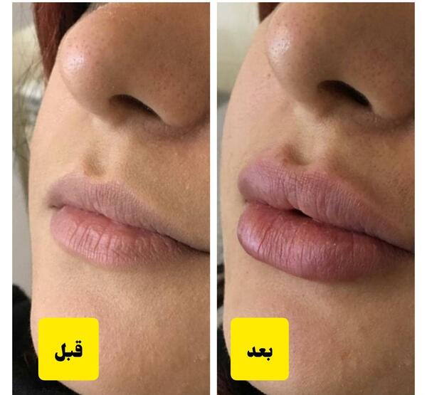 عکس لب لاکچری