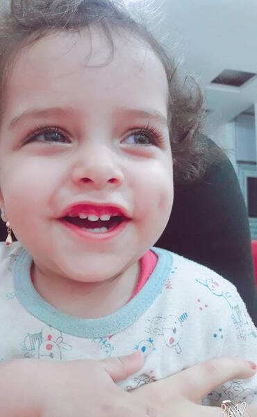عکس بچه چال لپ دار