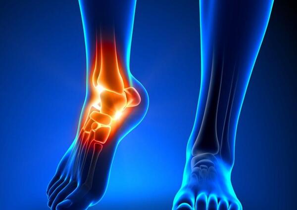 عکس ام ار ای مچ پا