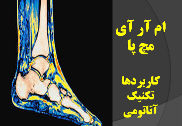 عکس ام ار ای مچ پا