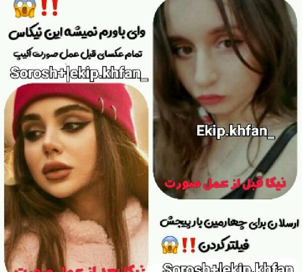 عکس لب های نیکا فلاحی