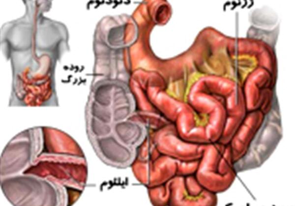 عکس واقعی روده انسان