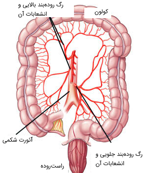 عکس واقعی روده انسان