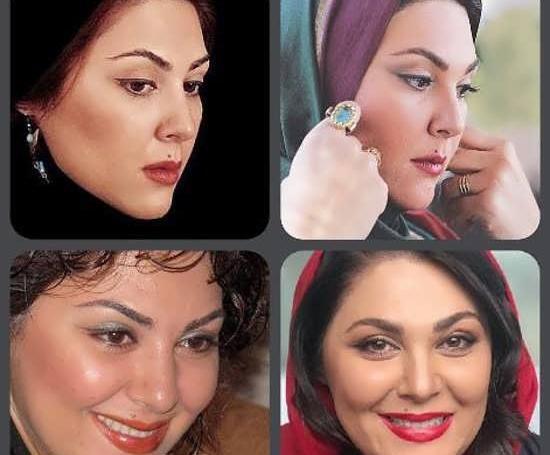 عکس قدیمی لاله اسکندری