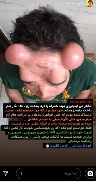 عکس حامد طهماسبی قبل از تصادف زندگی پس از زندگی