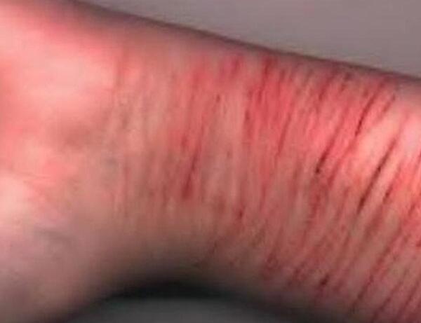 عکس رگ زدن شکست عشقی
