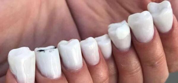 عکس ناخن ضربه خورده