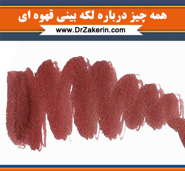 لخته خون عکس لکه بینی قهوه ای در بارداری