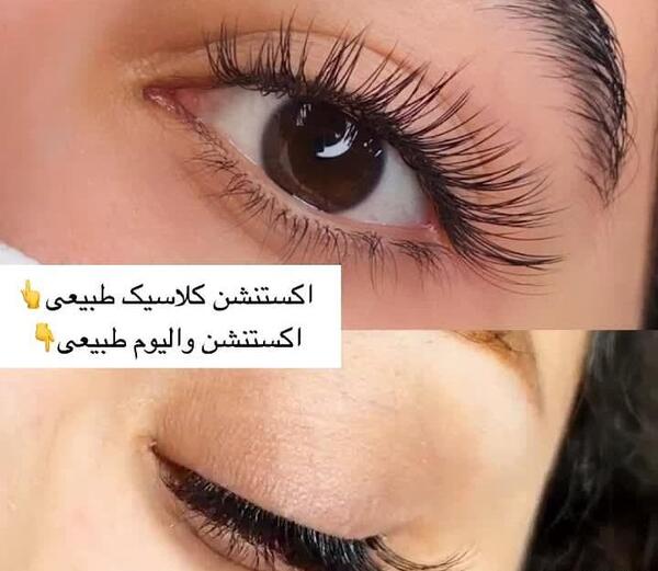عکس کاشت مژه کلاسیک