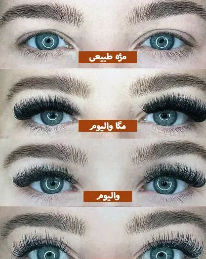 عکس کاشت مژه کلاسیک