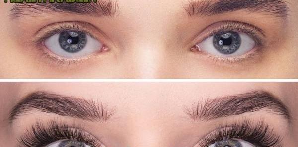 عکس کاشت مژه کلاسیک