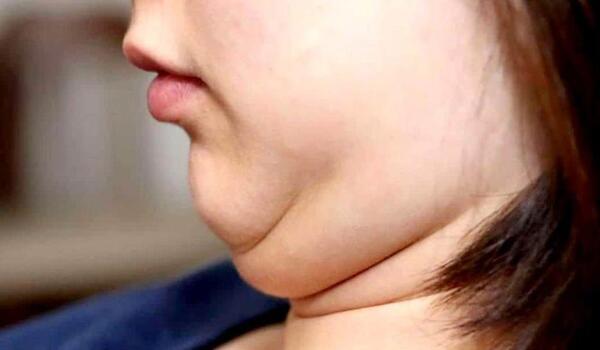 عکس غبغب نی نی سایت