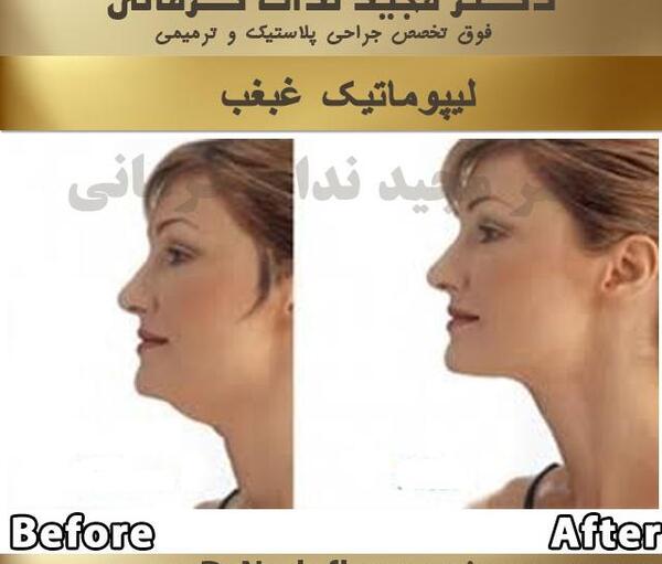 عکس غبغب نی نی سایت