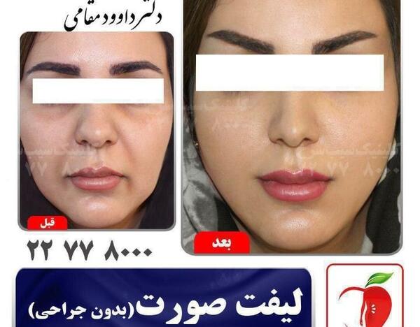 عکس غبغب نی نی سایت