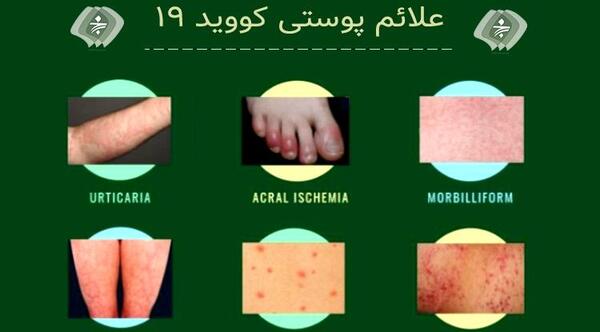 عکس علائم ویروس