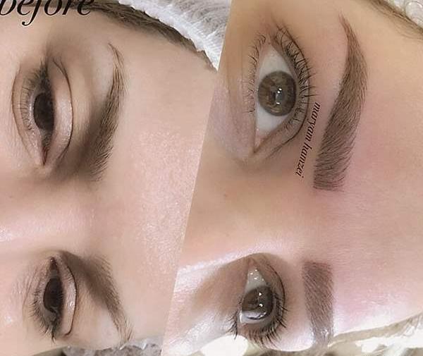 عکس کاشت ابرو نی نی سایت