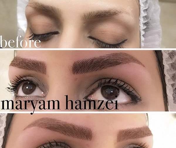 عکس کاشت ابرو نی نی سایت