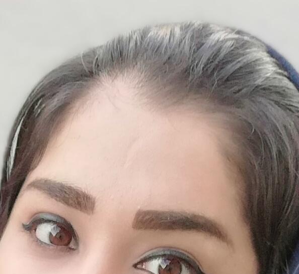 عکس کاشت ابرو نی نی سایت