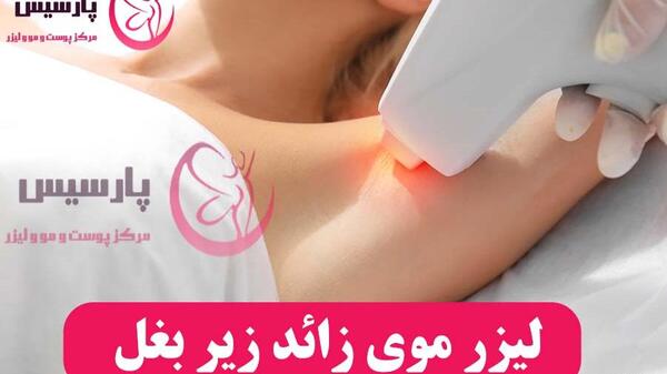 عکس لیزر موهای زیر بغل