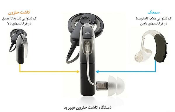 عکس کاشت حلزون جدید
