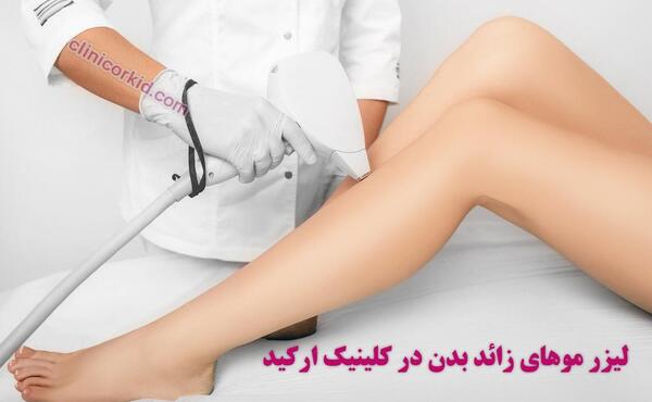 عکس تصاویر لیزر موهای زائد بدن