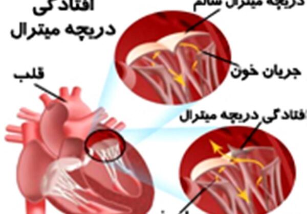 عکس دریچه قلب انسان