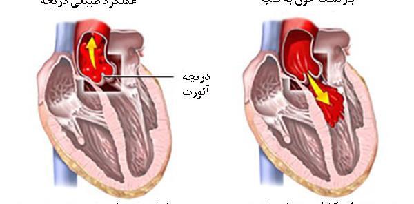 عکس دریچه قلب انسان
