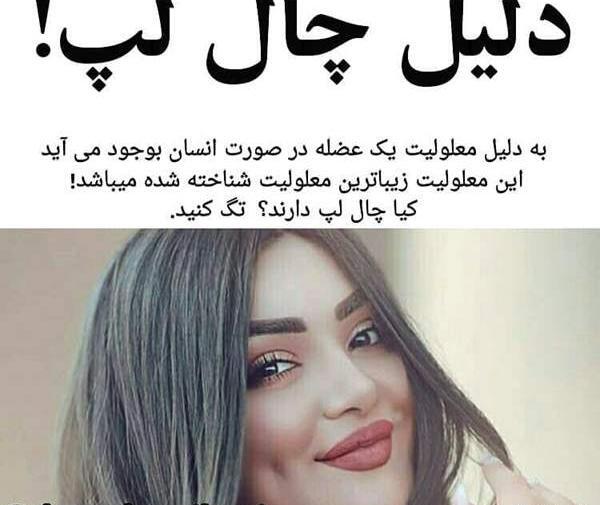 عکس بچه چال گونه دار