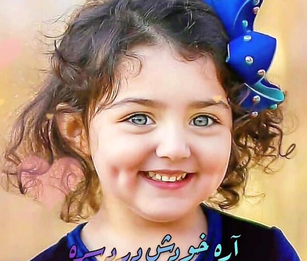 عکس بچه چال گونه دار