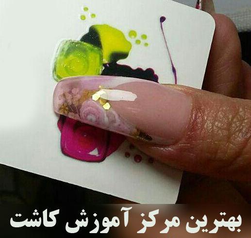 عکس کاشت استند گلس