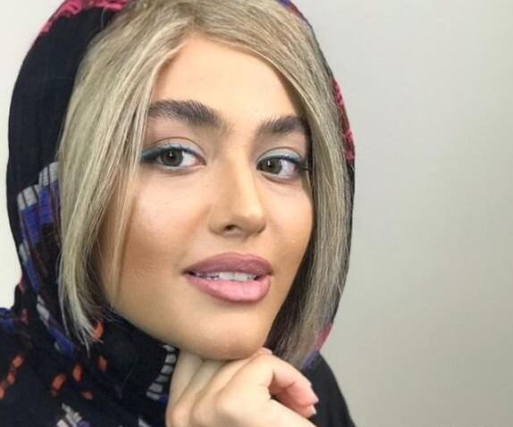 عکس لب زخمی ریحانه پارسا