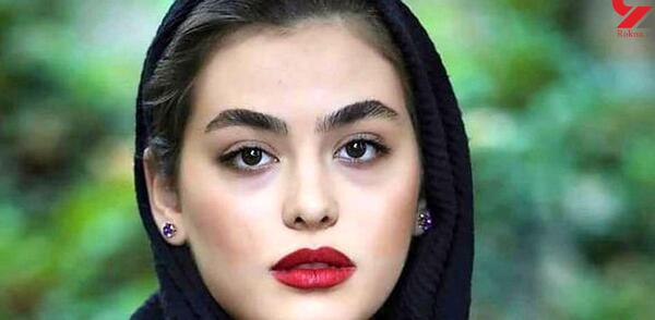 عکس لب زخمی ریحانه پارسا