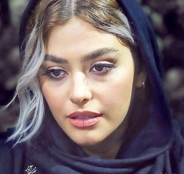 عکس لب زخمی ریحانه پارسا