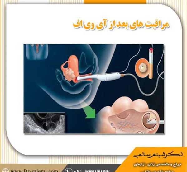 عکس آی وی
