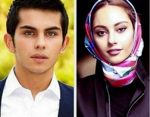 عکس واقعی پیشونی سفید