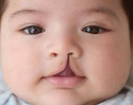 عکس لب نوزاد