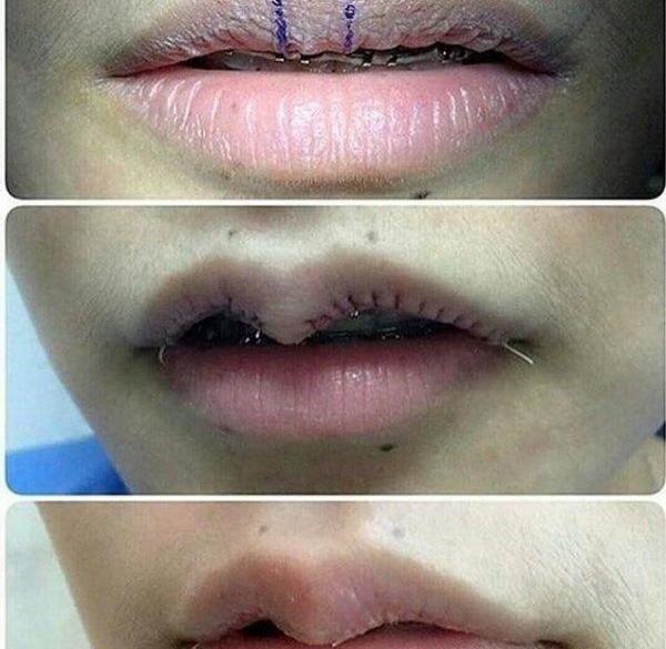 عکس لب خنده دار