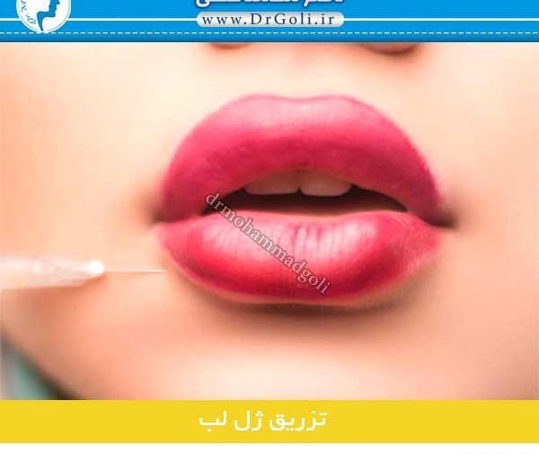 عکس لب ژل زده یک سی سی