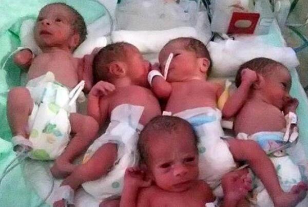 عکس نوزاد با وزن 2 کیلو