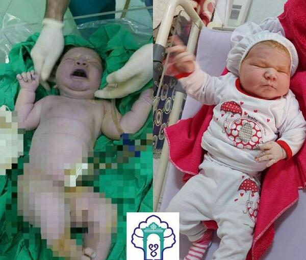 عکس نوزاد با وزن 2 کیلو