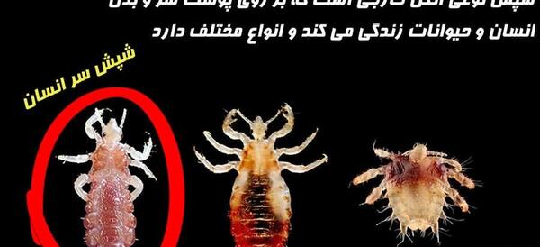 عکس شپش انسان
