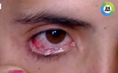 عکس گریه دختر چشم رنگی