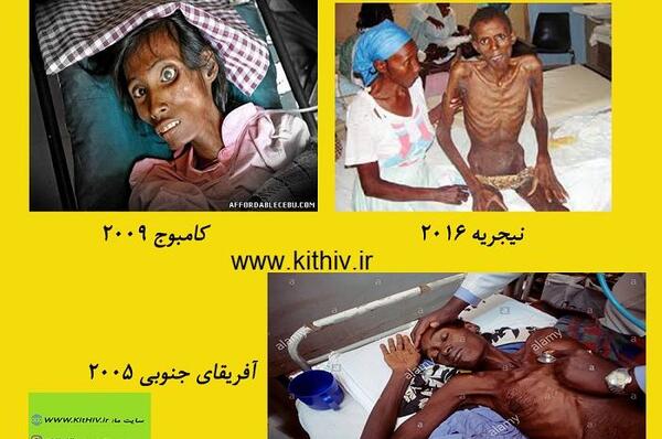 عکس ویروس ایدز