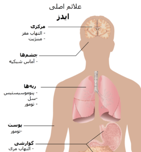 عکس ویروس ایدز