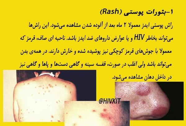 عکس ویروس ایدز