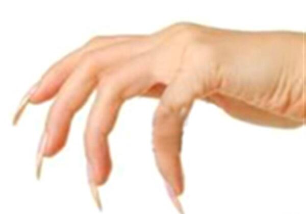 عکس عفونت کاشت ناخن