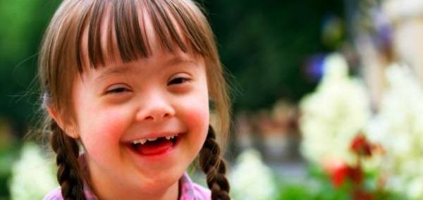 عکس دختر معلول ذهنی